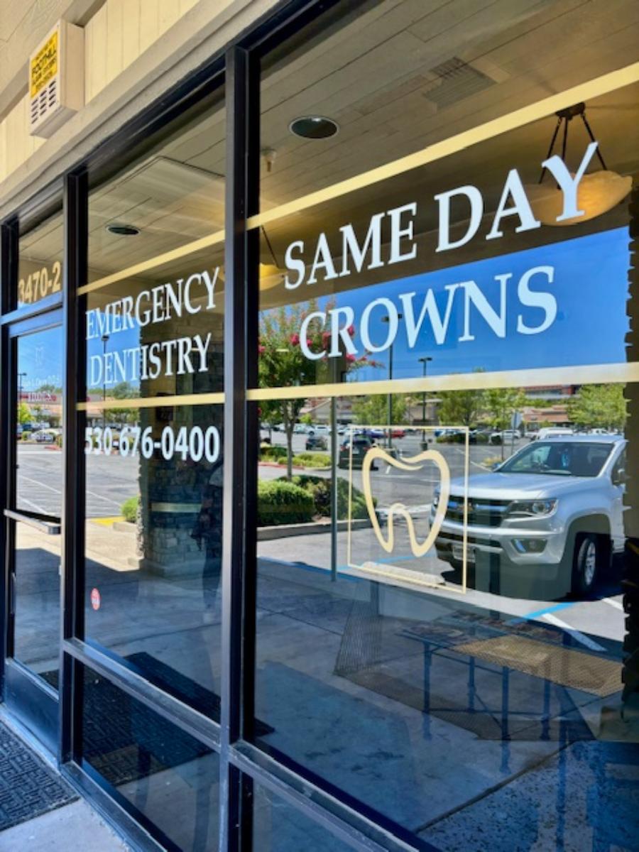 Cameron Park Dental Care | Preventative Program, Digital Impressions and Inlays amp Onlays