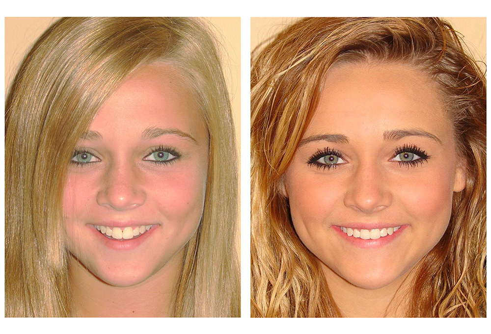 Cameron Park Dental Care