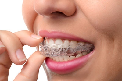 Cameron Park Dental Care | Dental Cleanings, Sports Mouthguards and Dentures