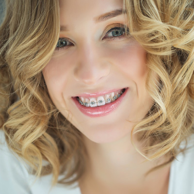 Cameron Park Dental Care | Veneers, Teeth Whitening and Extractions